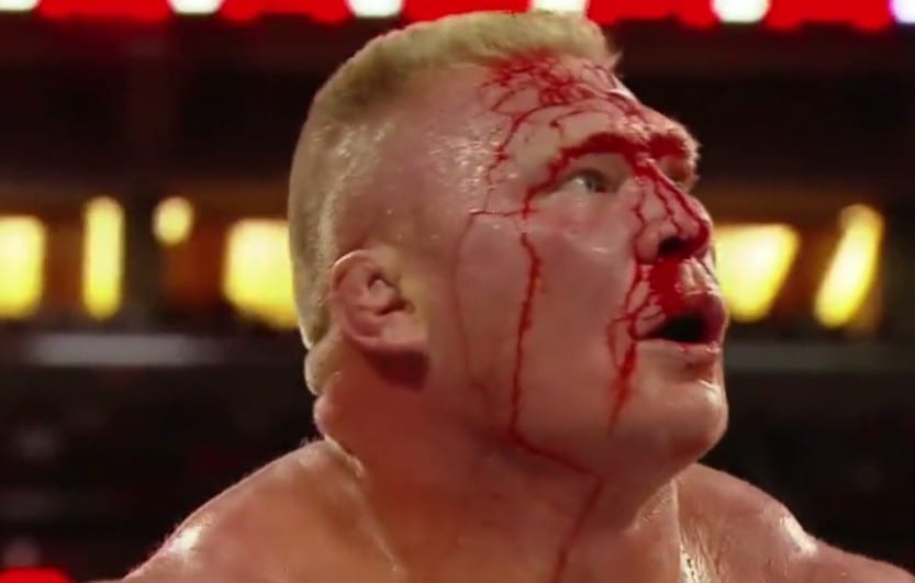 Brock Lesnar busted open at WrestleMania 31