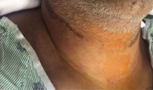 Brian Christopher's Neck Photo After Death
