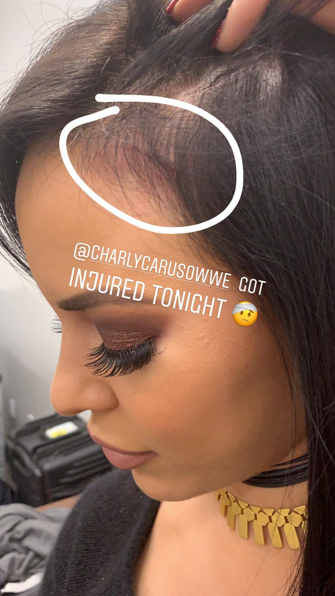 Charly Caruso Injured At WWE RAW Taping