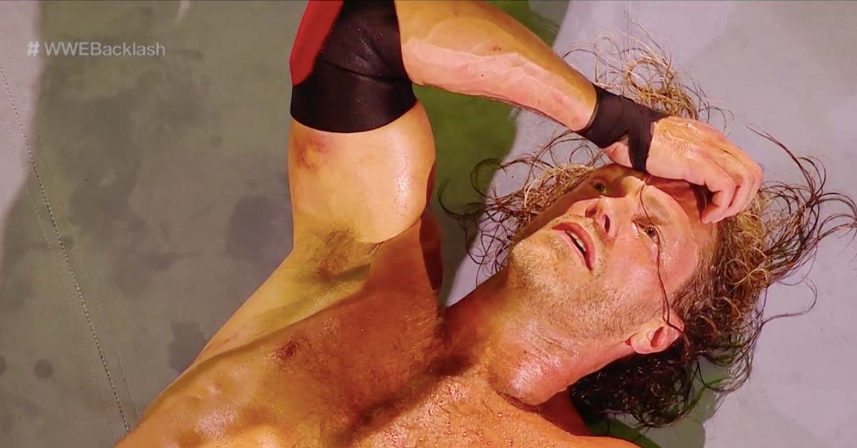 Photo Of Edge's Right Triceps Injury At WWE Backlash 2020