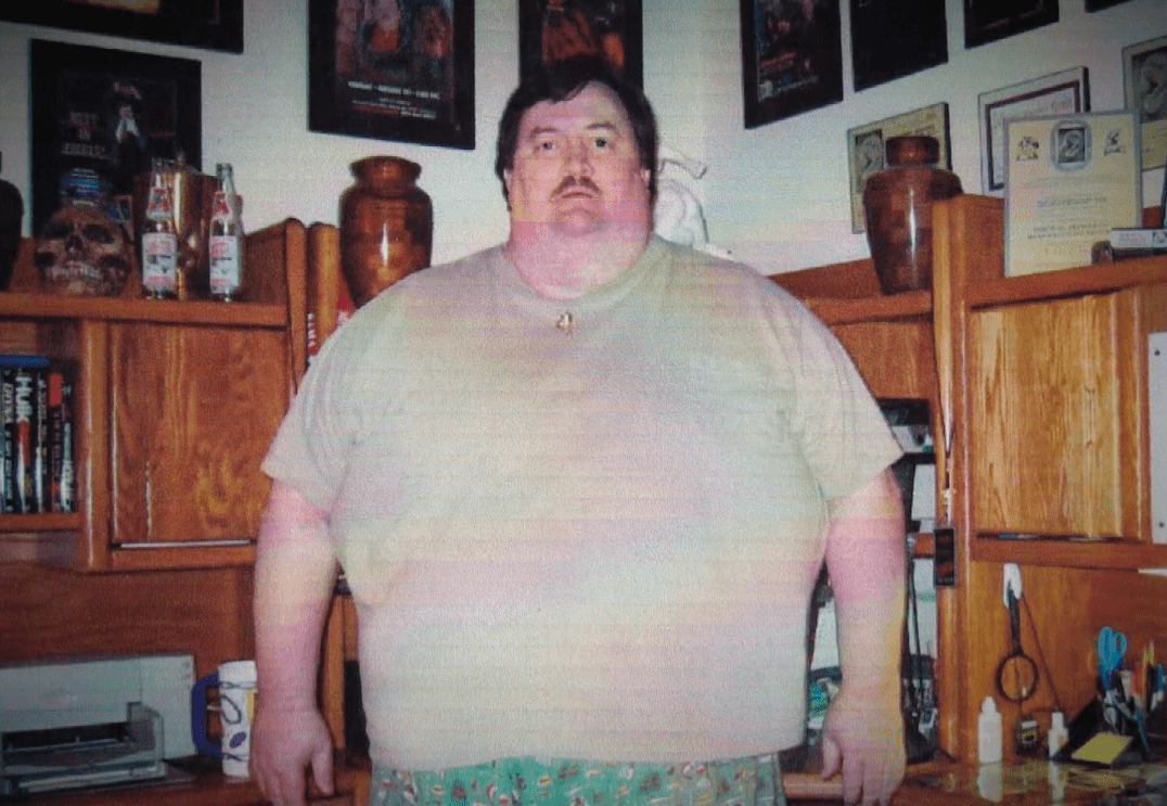 Paul Bearer Morbidly Obese 525 Lbs Before Gastric Bypass Surgery 2003