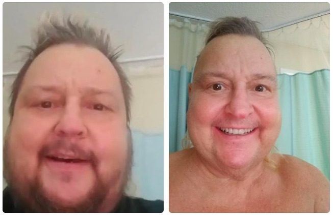 Brian Knobbs 60 pounds weight loss face before and after