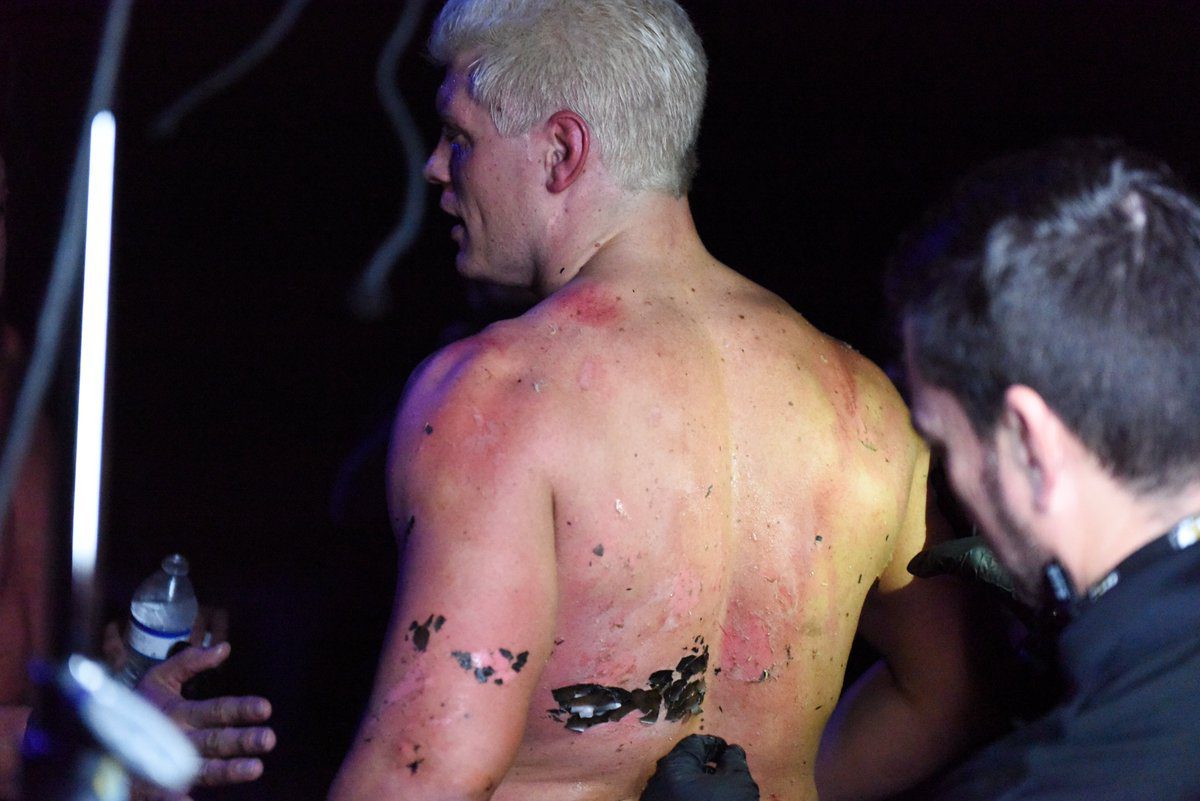 Condition Of Cody Rhodes Back After Fire Spot On AEW Dynamite - 2