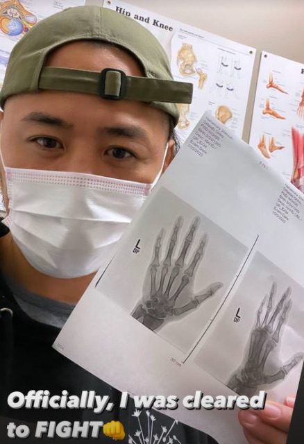 Shinsuke Nakamura recovers from hand injury X-Ray