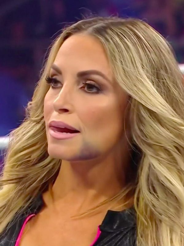 Trish Stratus Face Bruise On WWE RAW After Night Of Champions 2023