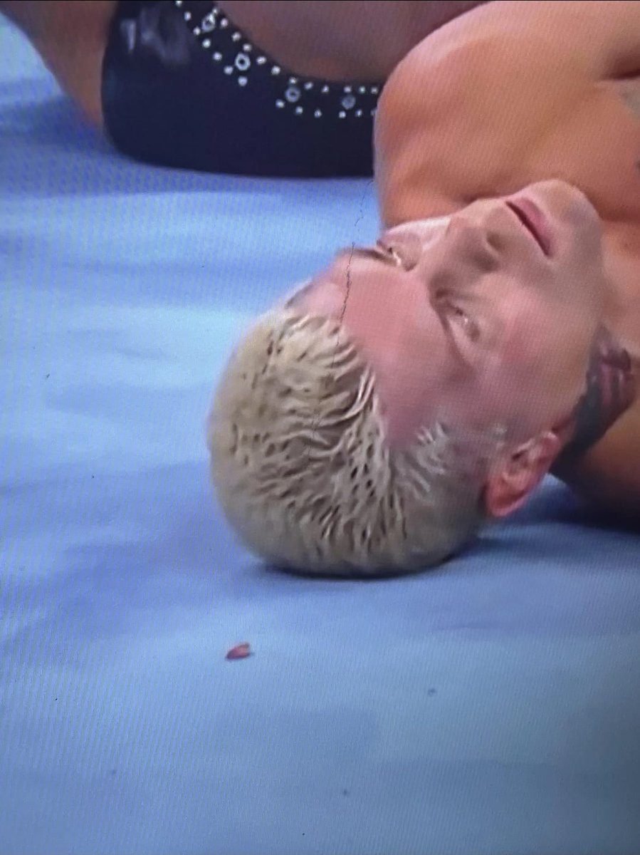 Cody Rhodes Loses Tooth After Claymore Kick WWE Royal Rumble 2024