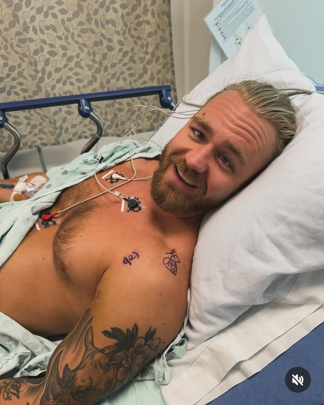 Tyler Bate Pec Chest Muscle Tendon Tear Surgery