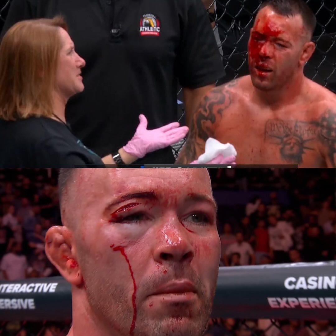 Colby Covington Busted Open Bleeding Face Eye Cut UFC Tampa December 14 2024