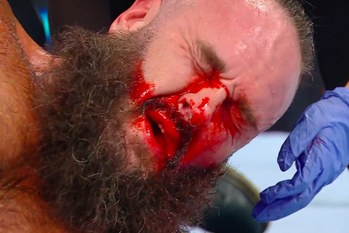 Braun Strowman Busted Open Bleeding Blood WWE Saturday Night's Main Event 2025 WrestleFeed App