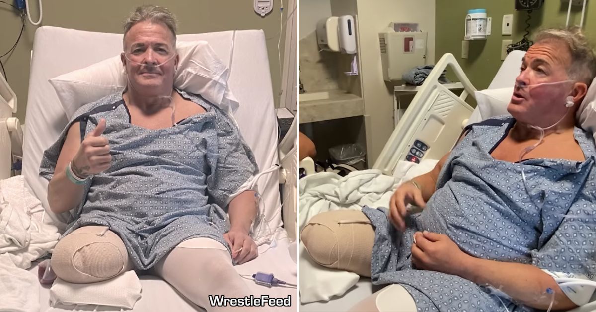 Marcus Buff Bagwell Leg Amputation Photos July 2025 WrestleFeed App