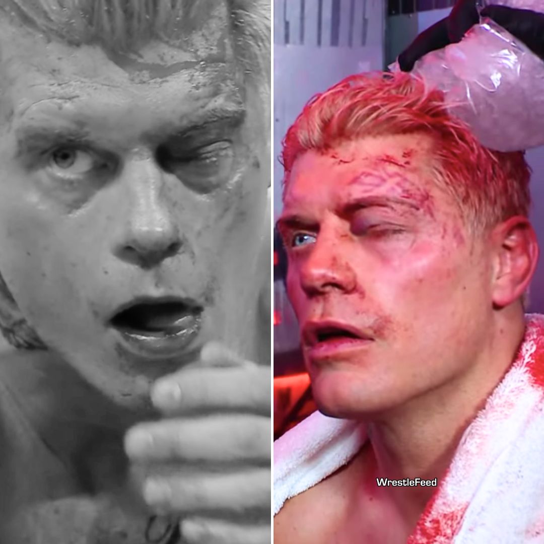 Cody Rhodes Eye Injury Hurt WrestleMania 42 Night 1 WWE 2026 WrestleFeed App