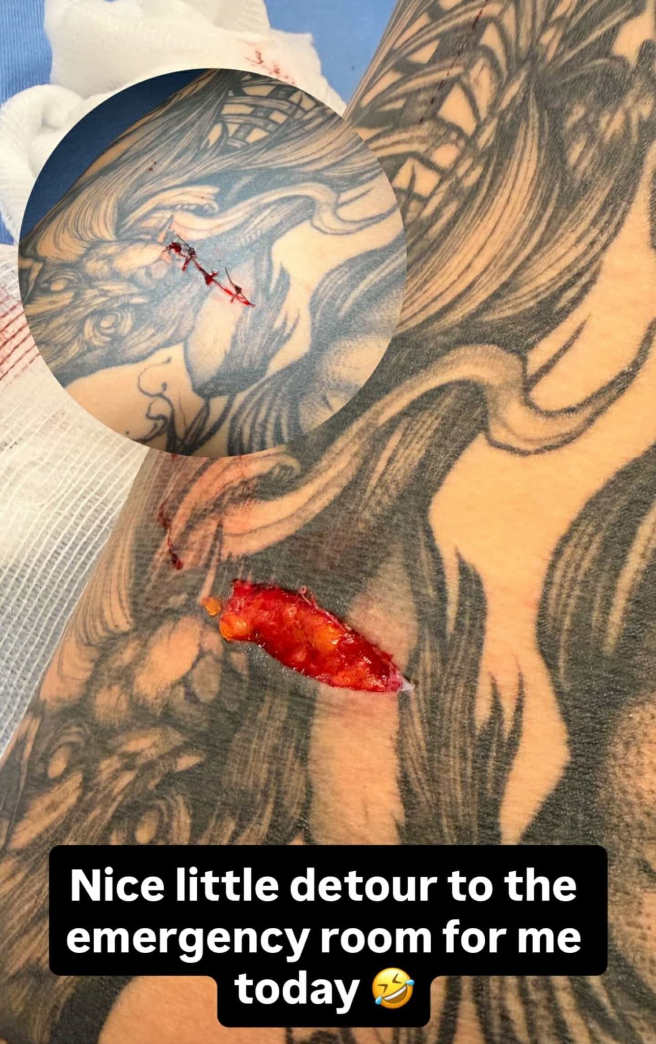 Rhea Ripley Cut Emergency Room Hospitalized April 8 2026